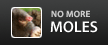 No More Moles